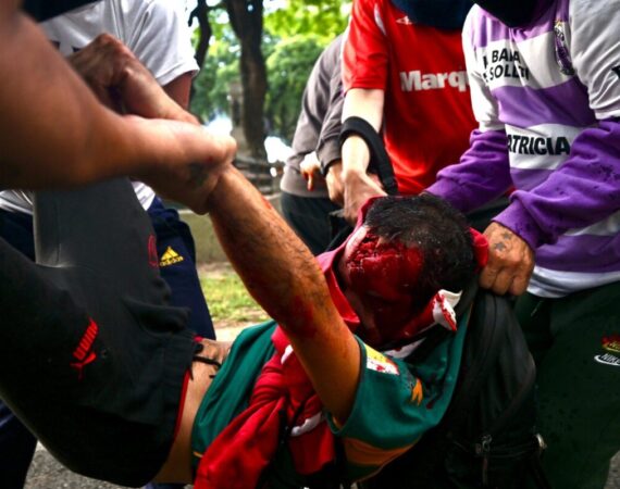 Represión salvaje: el fotógrafo Pablo Grillo sufrió un trauma grave de cráneo con pérdida de masa encefálica y se encuentra en pronóstico reservado